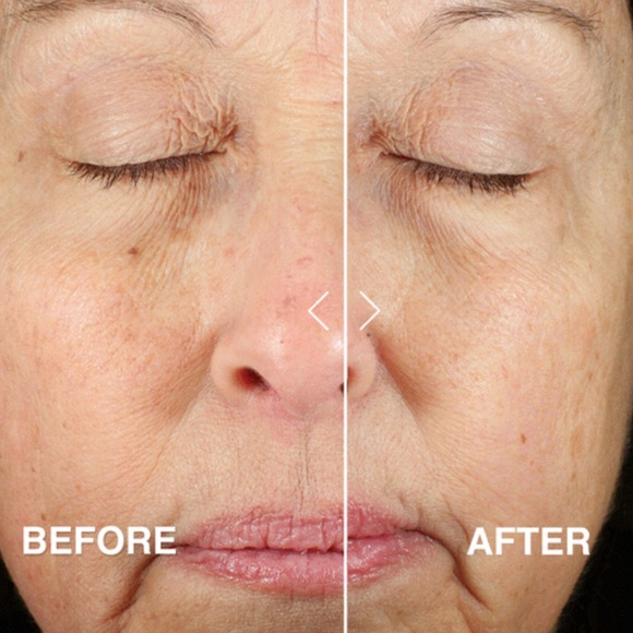 LAST 1! Derma E Anti-Aging Regenerative Day Cream Moisturizer 🪞 NEW - Picture 4 of 7